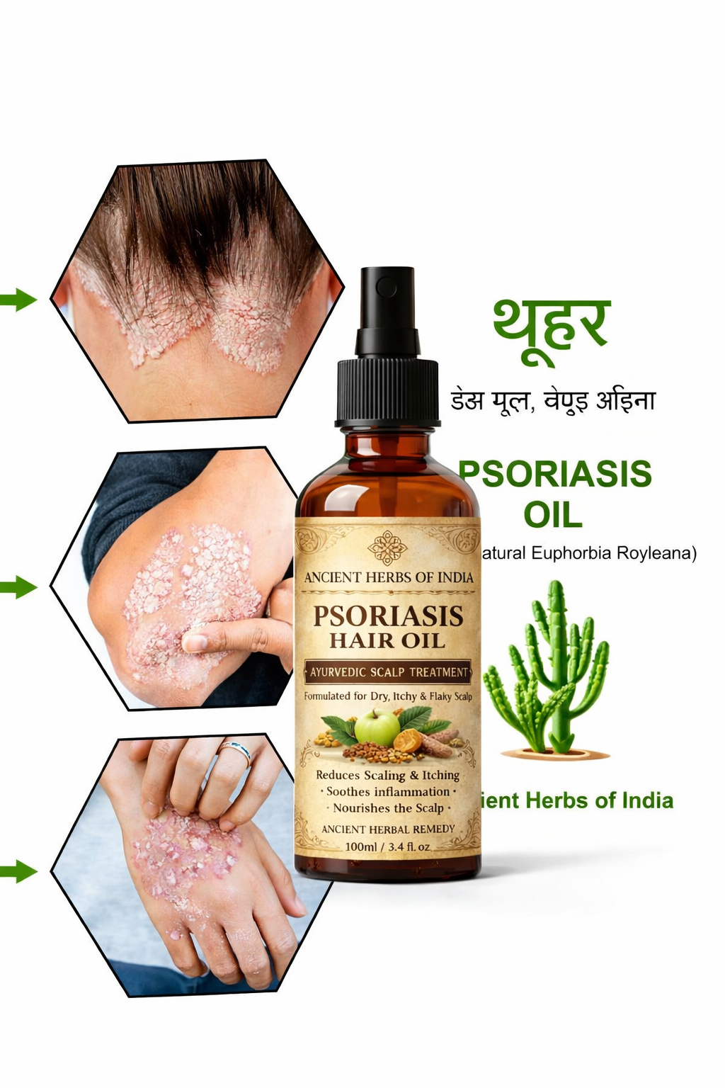 ANCIENT HERB OF INDIA PSORIA OIL ADVANCED AYURVEDIC RELIEF FOR SCALP & SKIN