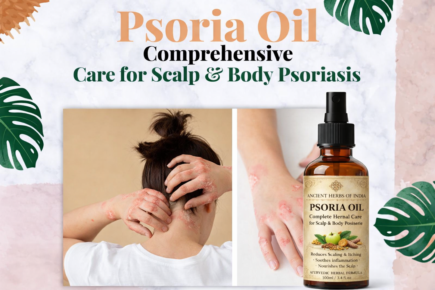 ANCIENT HERB OF INDIA PSORIA OIL ADVANCED AYURVEDIC RELIEF FOR SCALP & SKIN