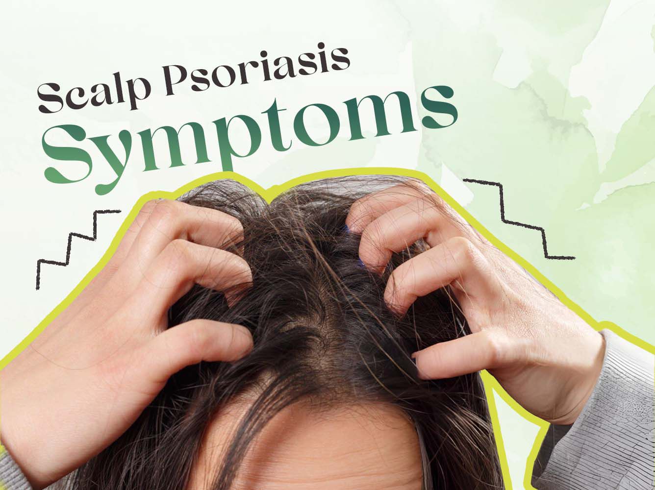 ANCIENT HERB OF INDIA PSORIA OIL ADVANCED AYURVEDIC RELIEF FOR SCALP & SKIN